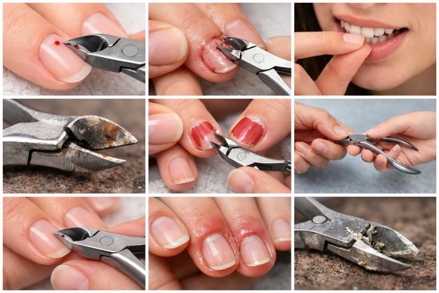 Cuticle Cutter: 9 Common Mistakes That Ruin Your Nails